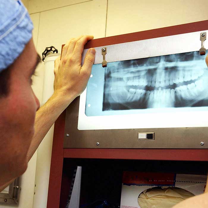 Doctor looking at X-rays