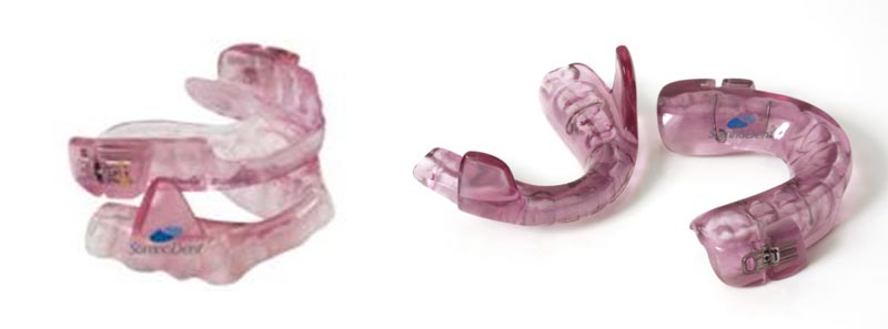 oral appliance therapy images
