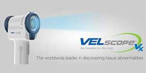 velscope
